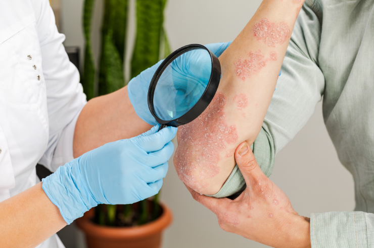 Dermatology Treatments